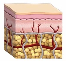 Etapas de la celulitis 1 Piel sin celulitis